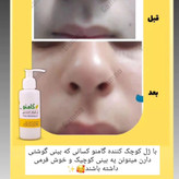 کوچک کننده بینی