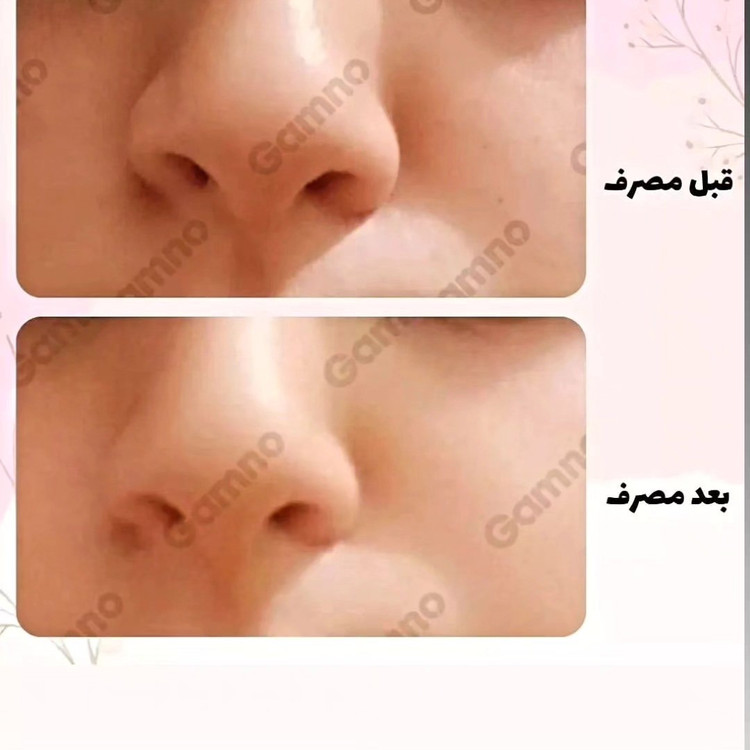 کوچک کننده بینی