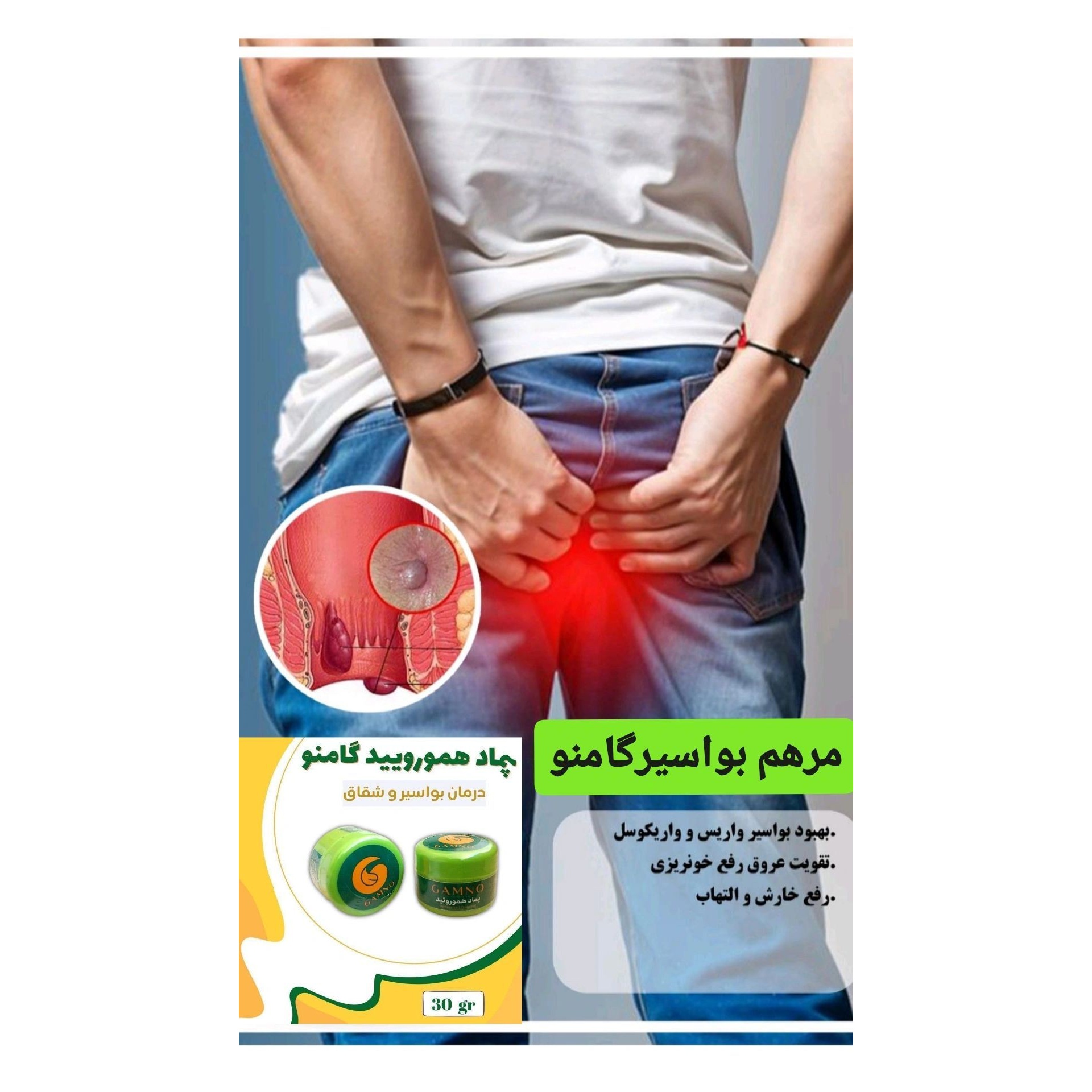 پماد درمان هموروئید