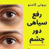 کرم دور چشم