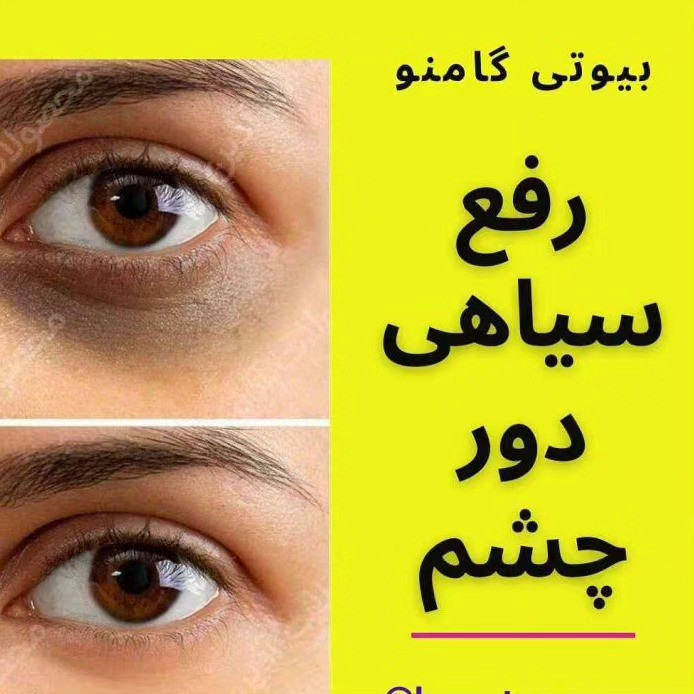 کرم دور چشم