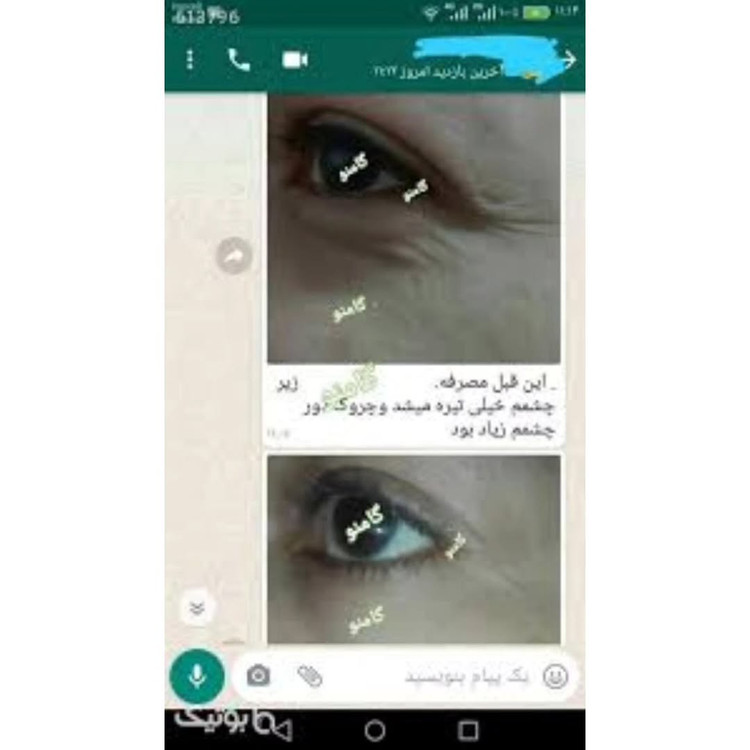 کرم دور چشم